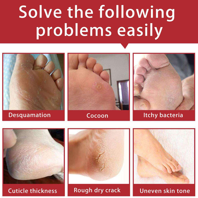 Foot Peel Sock Exfoliation Foot Peeling pack Repair Rough Heels Dead Skin Smooth Foot Mask