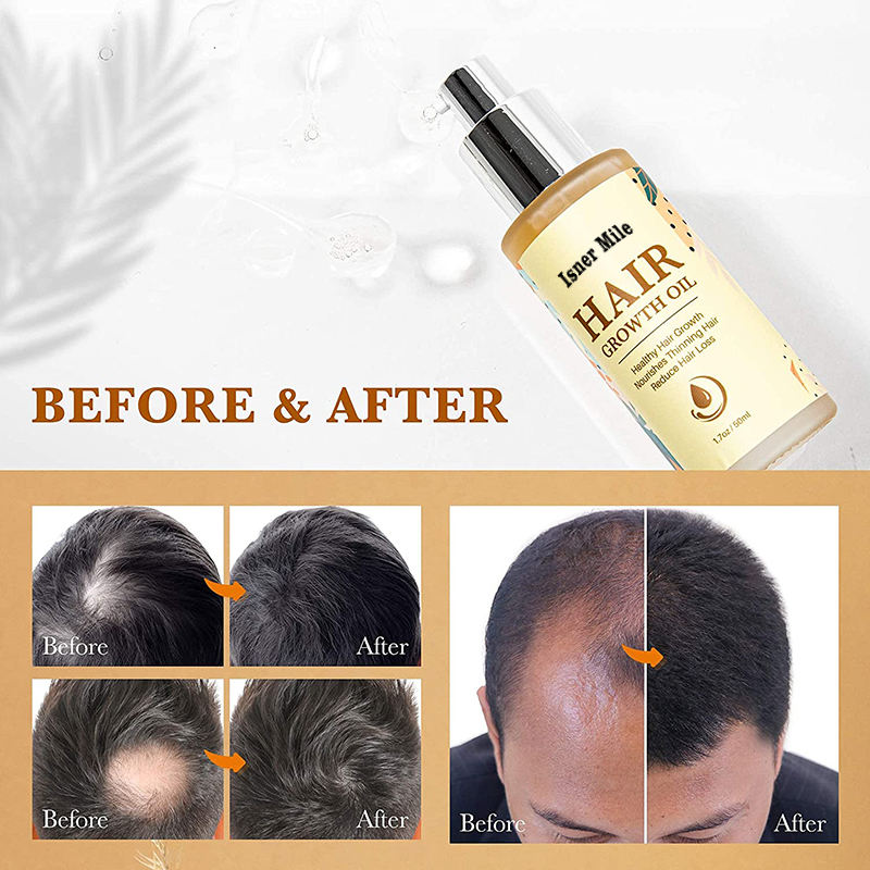 Natural private label organic anti-hair loss softee fast growth hair oil for black women hair