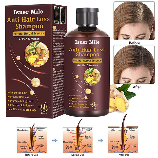Men Women Hair Loss Treatment Organic Hair Growth Thickening sclap Shampoo