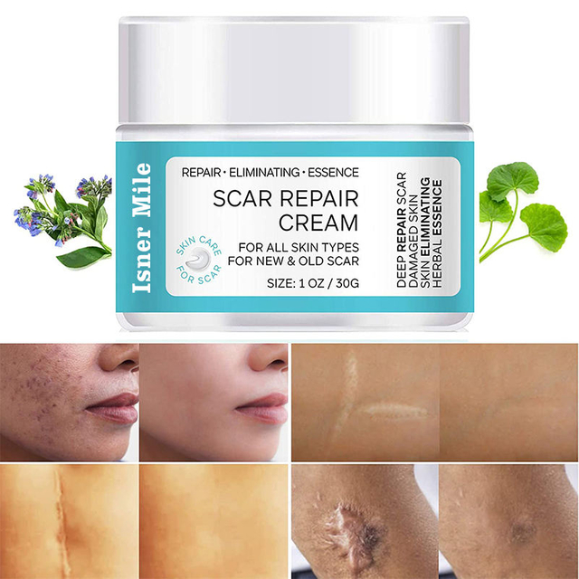 pure natural deep repair skin fade old new scar cream light wrinkle freckle whitening cream