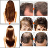 Women Hair Loss Treatment Growth Thickening Regrowth Faster Shampoo
