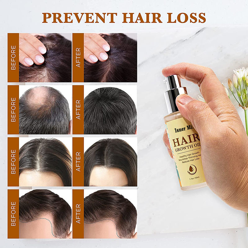 Natural private label organic anti-hair loss softee fast growth hair oil for black women hair