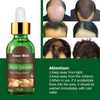 Private Label Wholesale natural organic Anti Hair Loss Repair Hair Hair Growth Oil Serum