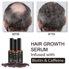 Hot Sell Natural Formula Wholesale Nourishing Hair growth Care Loss Treatment Hair Growth Oil serum