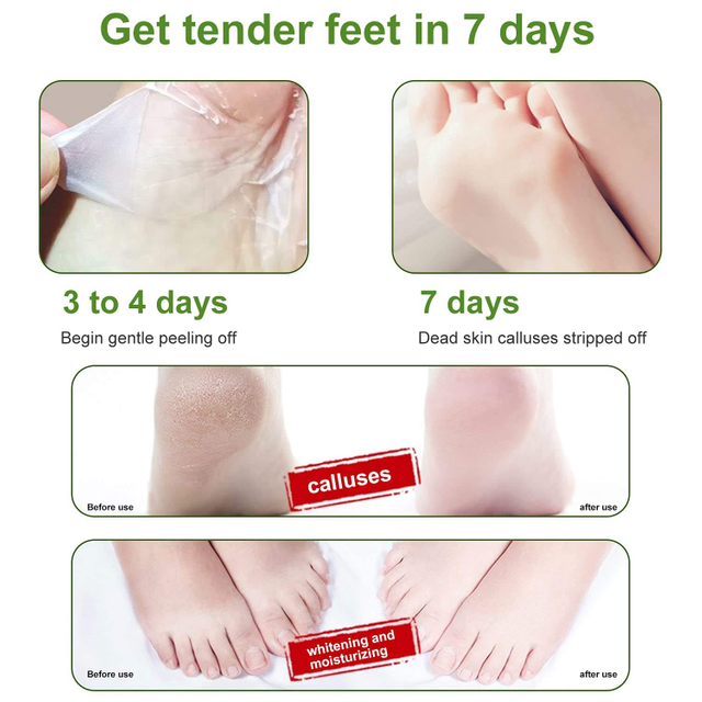 Foot Care Removes Repairs Cracked Heels Dead Skin Calluses Peel Mask