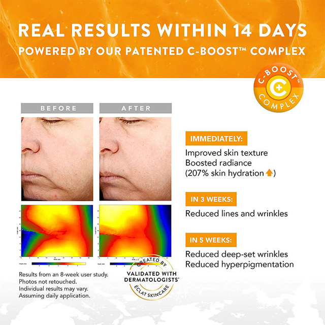 Vitamin C serum Dark Spot Serum Brighten Skin Squalane Vitamin C Fade Dark Spots