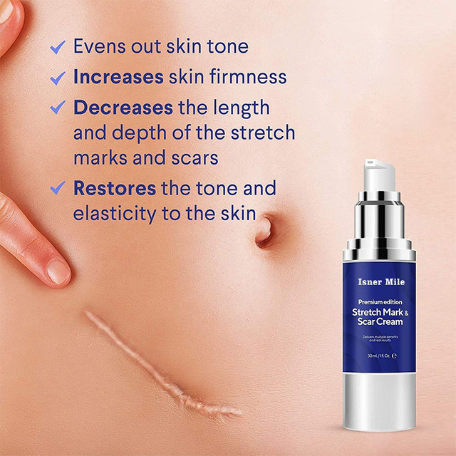 repair stretch marks fat marks removing pregnancy mark whitening cream pure natural fade scar cream