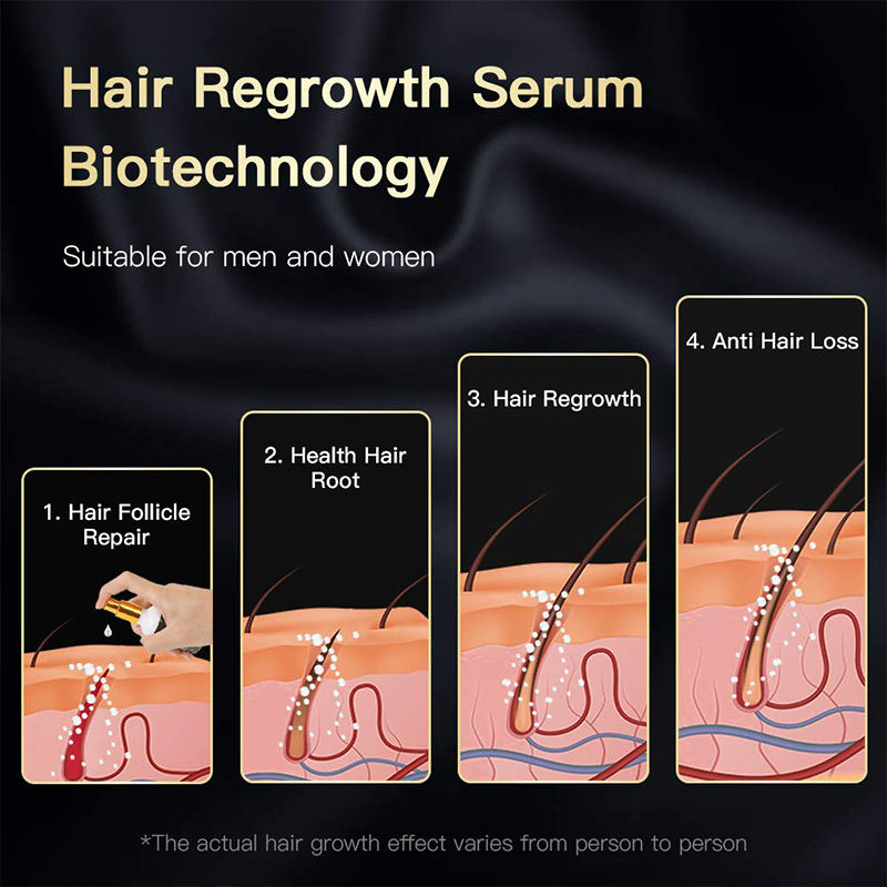 Private Label Organic Argan Oil Strenthening Repair Blueberry Extract Hair Growth Oil Serum