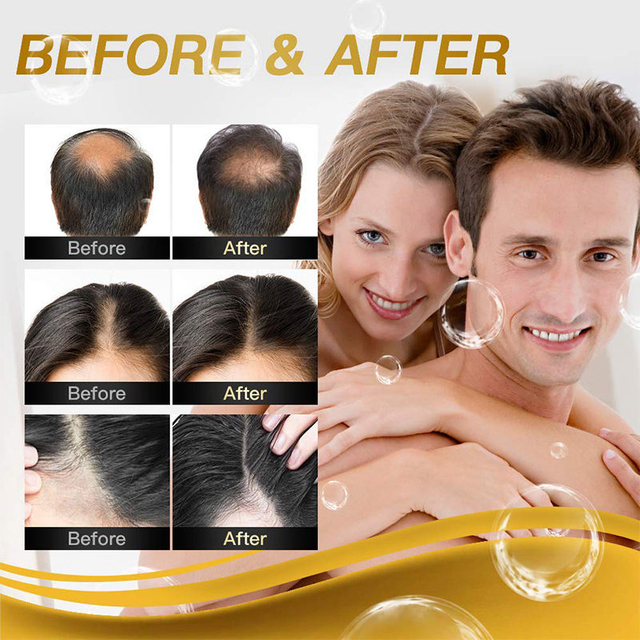 Private Label Organic Argan Oil Strenthening Repair Blueberry Extract Hair Growth Oil Serum