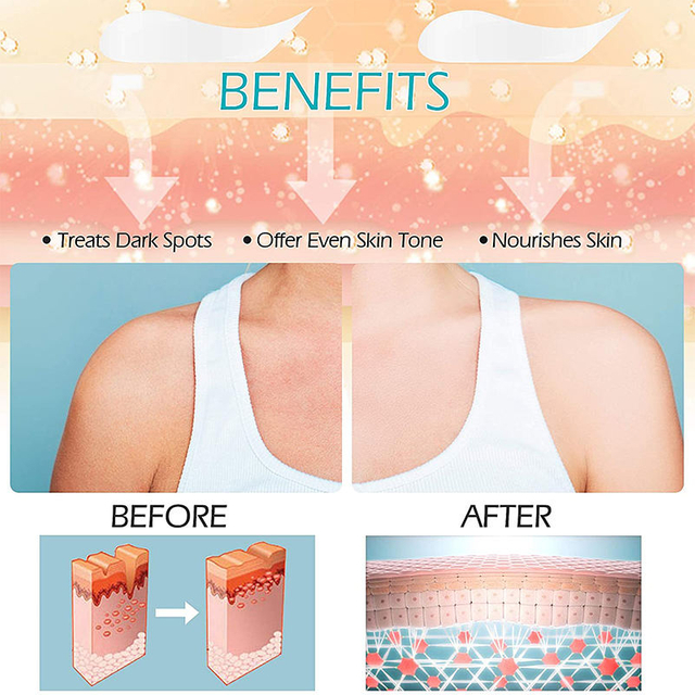 Whitening Dark Spot Lotion Moisturizes Lightening Bleaching Cream for Dark Skin