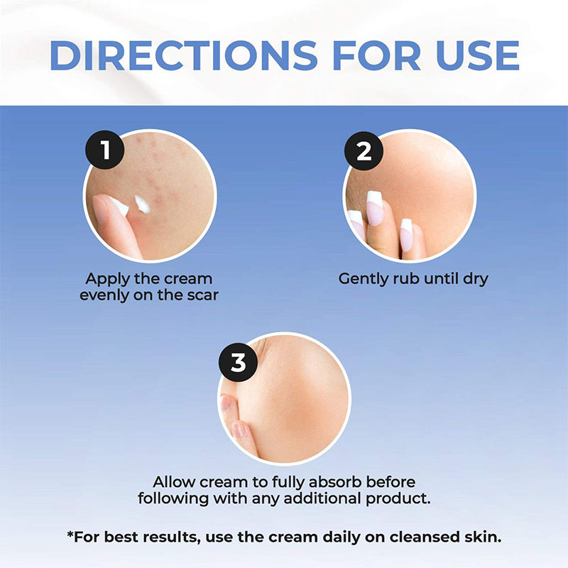organic deep repair stretch mark cream natural scar repair gel acne scar removing cream