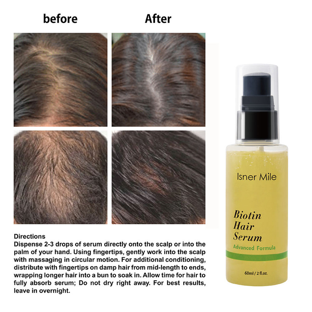 OEM Biotin Hair Growth Serum Hair Tonic Care Serum Grow Healthy Strong Hair Suitable for Men and Women