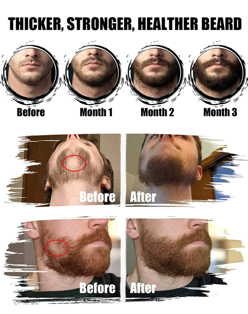 Organic Private Label Men's Beard Grooming Kit Beard Growth Kit